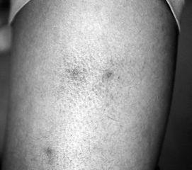 蜈蚣会吃瓜么,揭秘它们对瓜类食物的态度